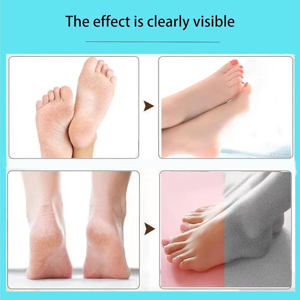 Electric Feet Callus Remover