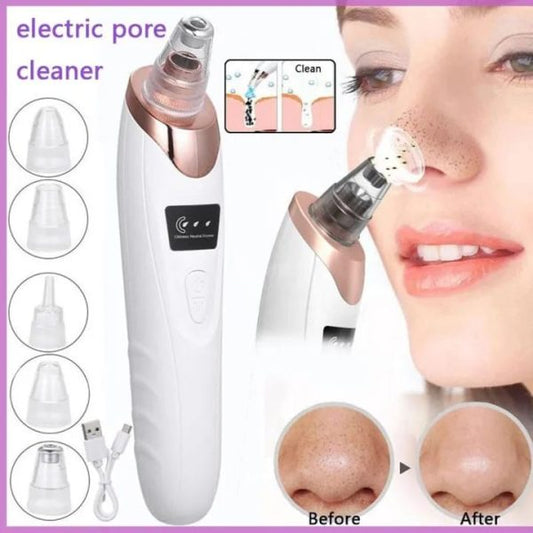 Blackhead Remover Vacuum